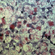 Bacterias Mycobacterium leprae en un cultivo (en rojo). Foto: Wikipedia.